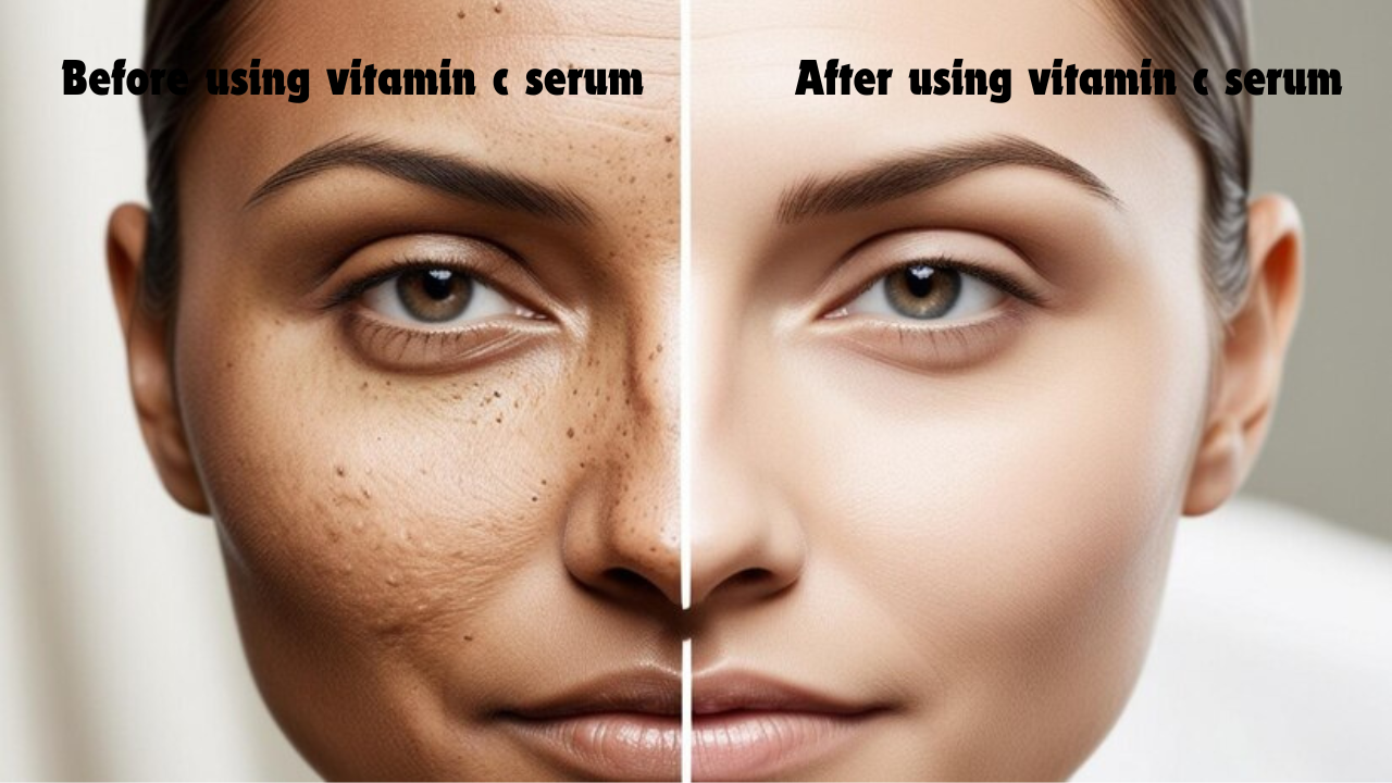 Vitamin C Serum Before and After Transformation of Your Skin