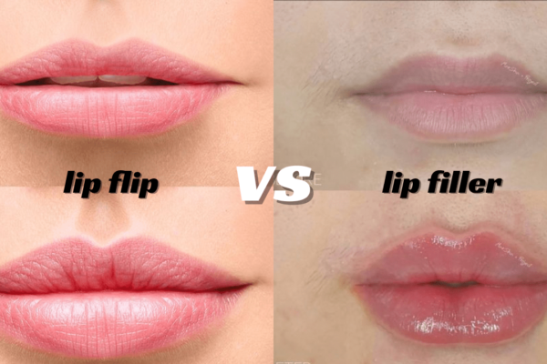 Lip Flip: The Secret to Fuller Lips Without Fillers