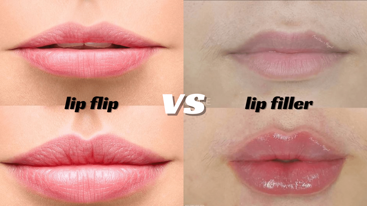 Lip Flip: The Secret to Fuller Lips Without Fillers